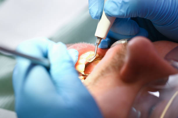 Best Urgent Care for Lost Fillings or Crowns in Baxter, MN