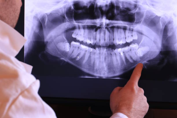 Best Emergency Dental Care for Broken or Chipped Teeth in Baxter, MN