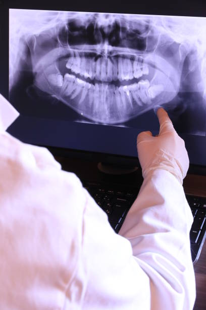 Best Emergency Tooth Extraction in Baxter, MN