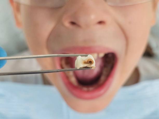 Best Emergency TMJ Treatment in Baxter, MN